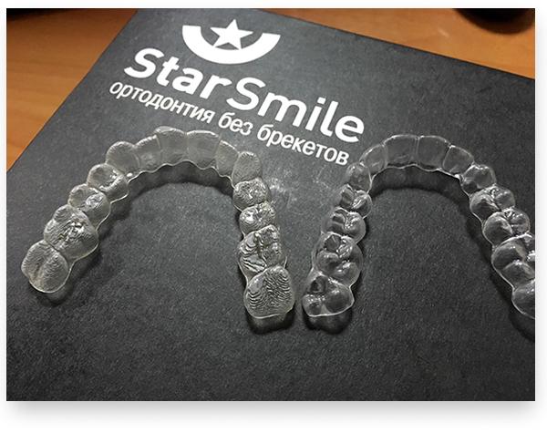 Как Star Smile за 6 лет покорила 5 стран изображение 3